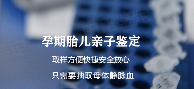 甘孜孕期亲子鉴定如何做,甘孜孕期亲子鉴定机构地址和电话 甘孜孕期亲子鉴定如何做,甘孜孕期亲子鉴定机构地址和电话