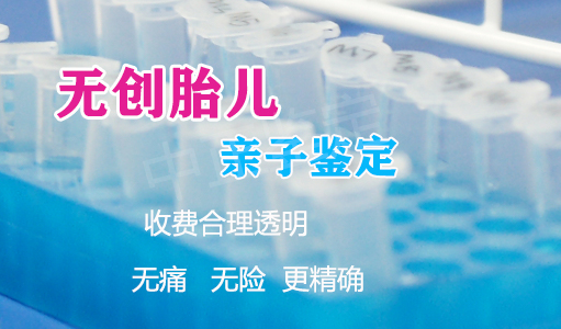 刚怀孕甘孜怎么做孕期亲子鉴定,甘孜办理怀孕亲子鉴定结果准确吗 刚怀孕甘孜怎么做孕期亲子鉴定,甘孜办理怀孕亲子鉴定结果准确吗